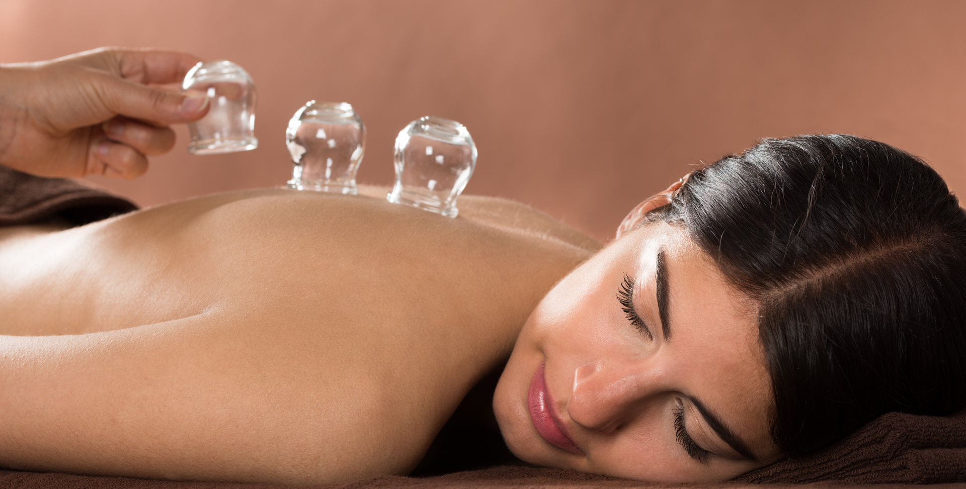 cupping therapy