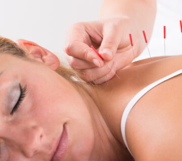 acupuncture in Laguna Hills California