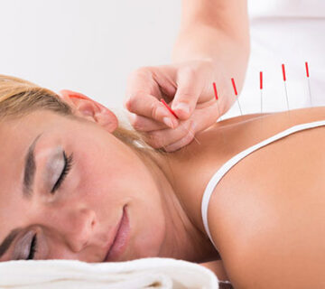 acupuncture in mohebbi wellness